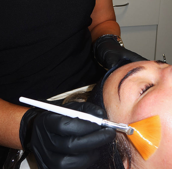 Close-up of chemical peel treatment at HLP Advanced Skin clinic in Prestatyn, North Wales
