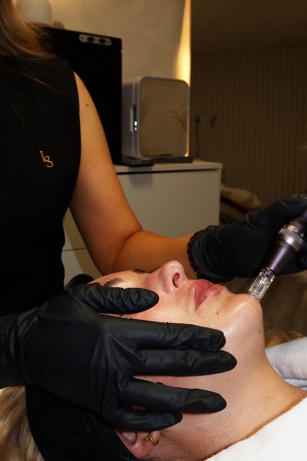 Microneedling treatment being performed at HLP Advanced Skin clinic in Prestatyn, North Wales